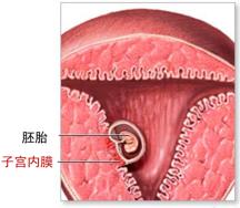 子宫内膜的炎症,大块的子宫内膜