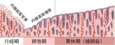 子宫内膜的炎症,大块的子宫内膜