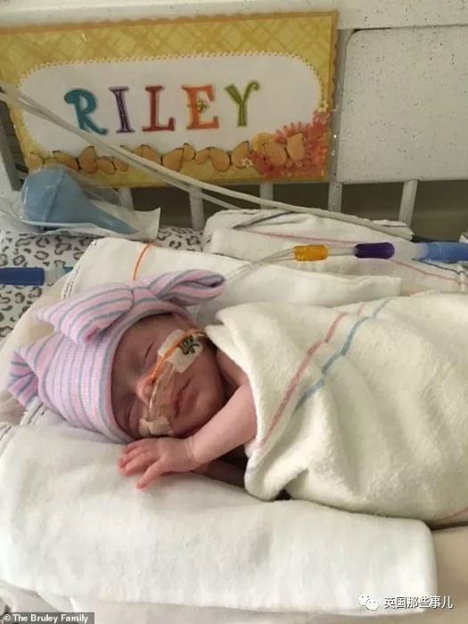 同卵双胞胎体重相差0.8斤正常吗,同卵双胞胎一个胖一个瘦