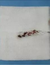 26岁小伙熬夜加班,26岁小伙熬夜头晕