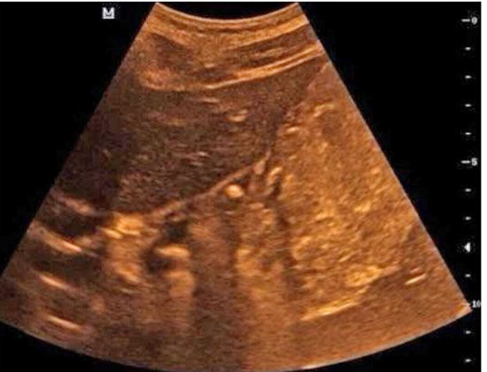 中学生老是胃疼怎么回事,高中女生胃疼是什么原因