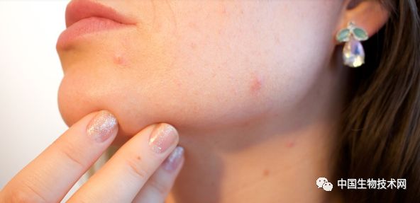 Science子刊：为什么一些护肤品会引起皮炎？