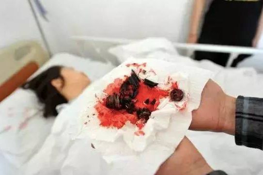 办公室椅子爆炸,办公室椅子爆炸案例