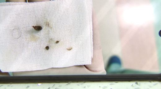 女孩肚子痛还流血，走路都不对劲了