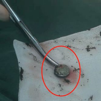 女孩肚子痛还流血，走路都不对劲了