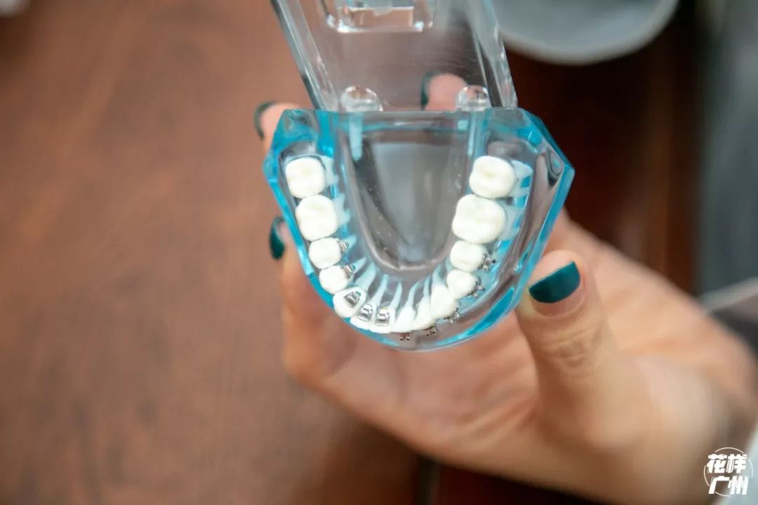 种牙免费送,种牙优惠活动免费检查是真的吗