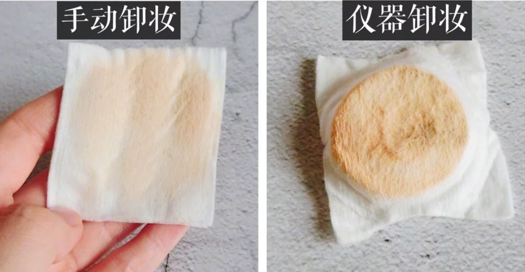 洗完脸后脸部还是能擦出脏东西,洗完脸后才知道脸上这么脏