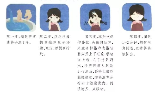 过敏性结膜炎的自我疗法,解析过敏性结膜炎的症状及治疗