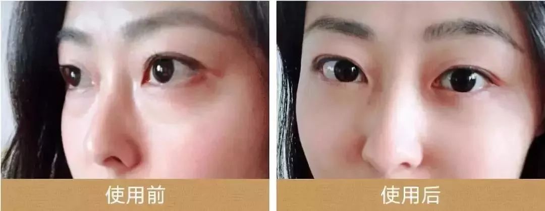 马应龙水晶眼膜视频,马应龙八宝多肽眼膜