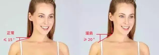 练肩穿衣服最有效的动作,如何提高气质不勾肩搭背