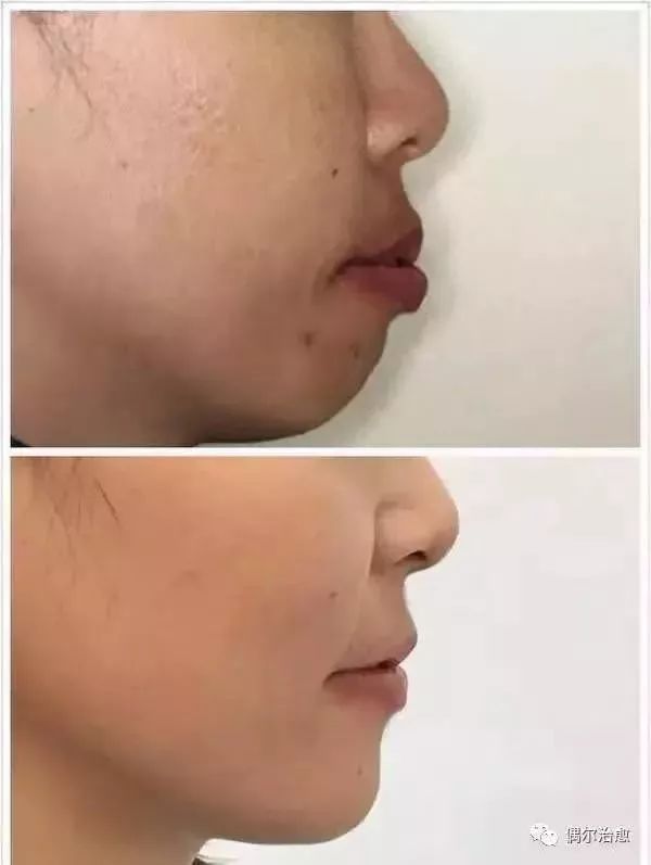 你还在整牙吗,你会花大价钱整牙吗