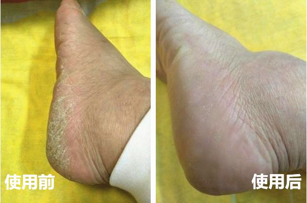 3秒速溶,2秒速溶