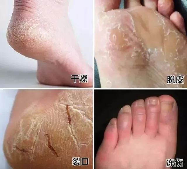 零下20度穿不冷鞋,零下20度也不挨冻