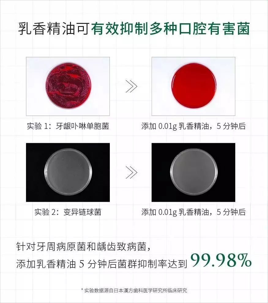 日本口腔牙膏,日本牙膏专治牙黄口臭的牙膏