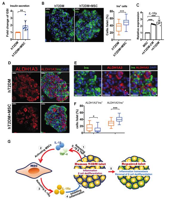 胰岛干细胞治疗糖尿病,间充质干细胞回输对糖尿病效果