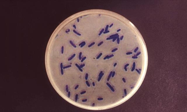 防止细菌感染喷雾,每天喷什么能消毒防感染