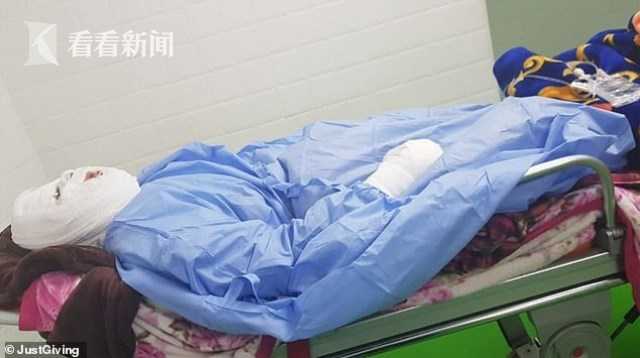 女子熟睡中惨遭毒手,熟睡烧伤女孩后续