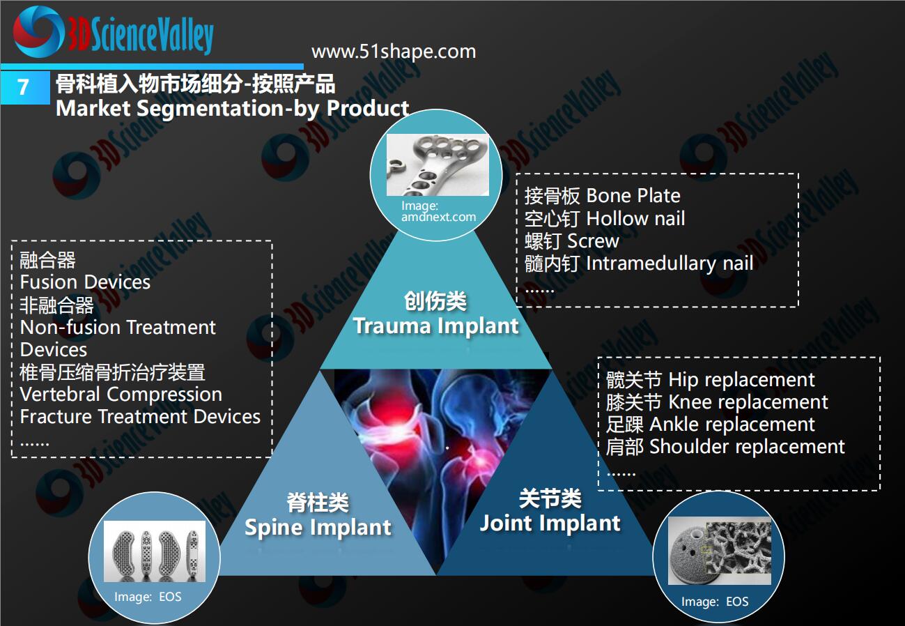 3d打印颈椎矫正器,3d打印腰椎融合器多少钱