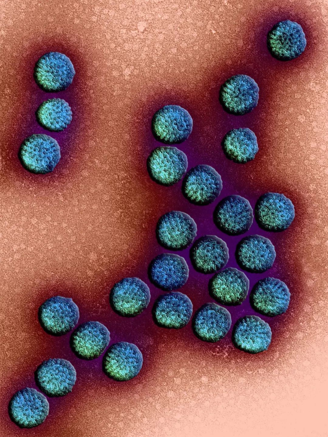 鍋囧鐥呮瘨鎰熸煋浜嗘垜,鍋囧鐥呮瘨鎰熸煋浜嗕綘