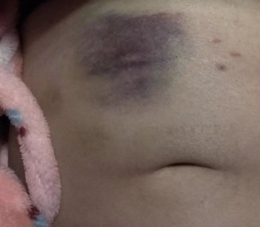 武汉留守孕妇,武汉留守孕妇的心酸