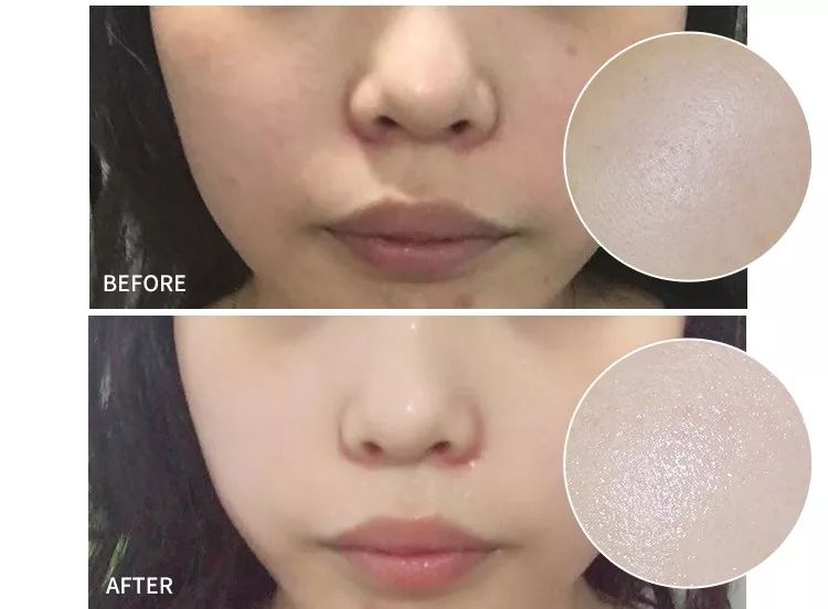 艾珂薇acwelln4抗敏感保湿面霜,推荐敏感肌使用保湿力度强的面霜