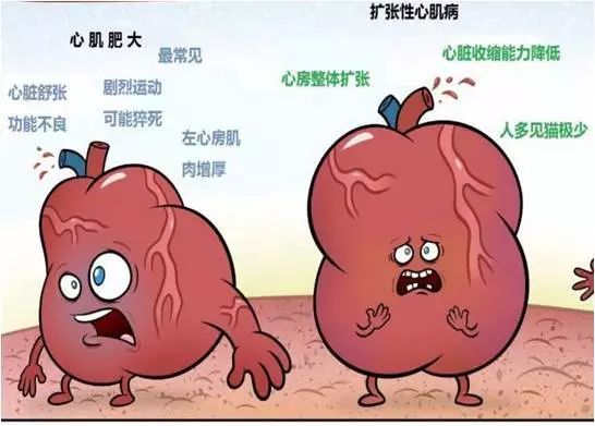 扩张型心肌病用什么消融,梗阻性肥厚性心肌病开胸手术恢复