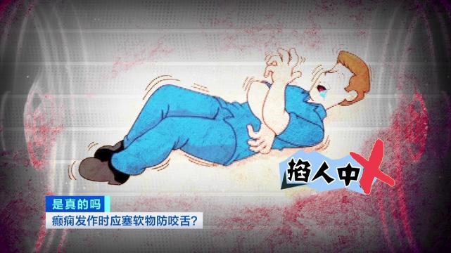 癫痫发作咬舌严重的怎么急救,防止癫痫发作咬舌平常准备什么