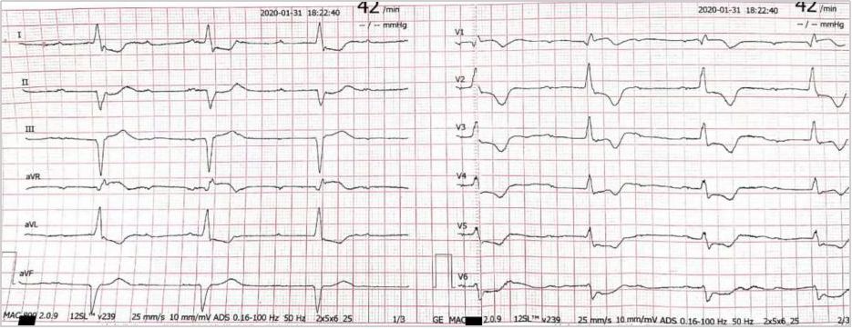 pd1单抗皮质醇,pd-1单抗治疗的前提