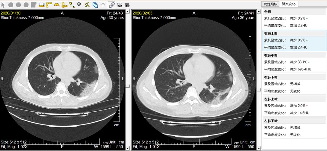科技创新与医院科技战疫,科技力量助力疫情防控