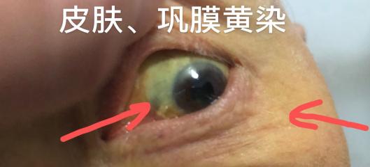 烟台毓璜顶医院黄庆先主任,毓璜顶医院肝胆科黄庆先哪天坐诊