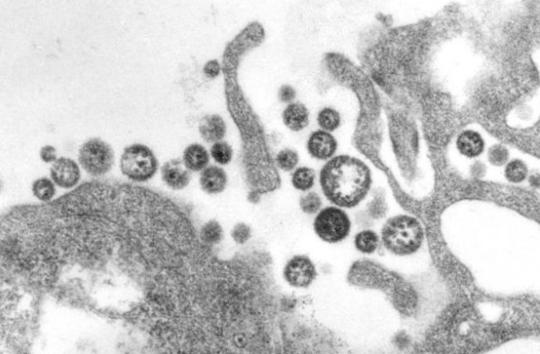 战疫史志⑱医学进步启示录|P4实验室:大自然魔鬼的“囚室”病毒研究的“航母”