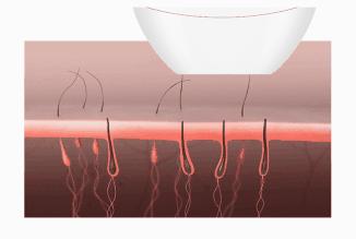 居家脱毛仪的推荐,家用脱毛仪哪一款光波最深
