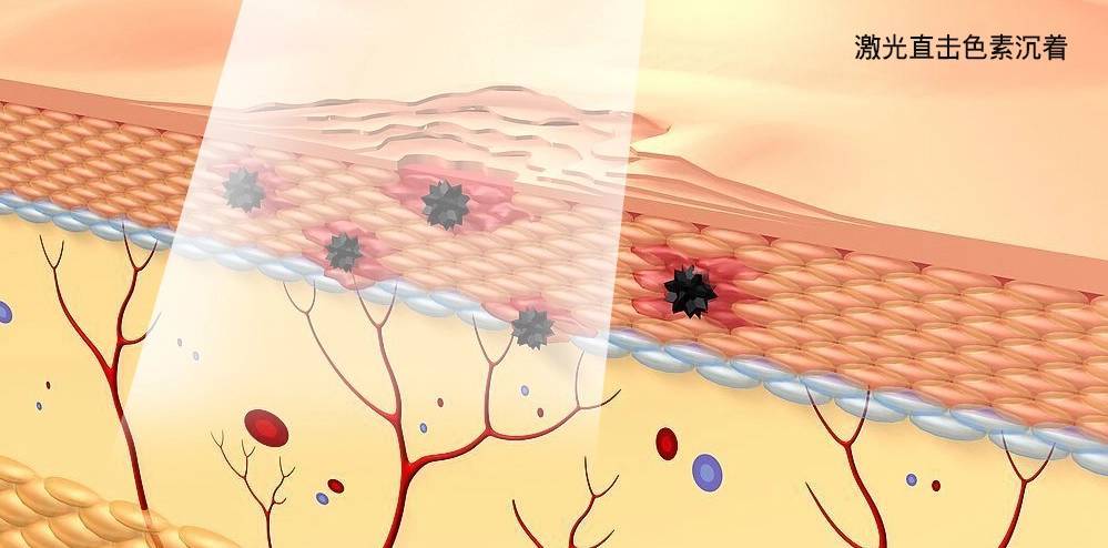 居家脱毛仪的推荐,家用脱毛仪哪一款光波最深