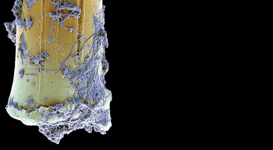 口腔新神器：漱口30秒+光照10分钟，专杀你的有害菌