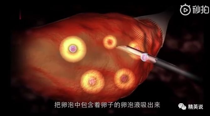 32岁没结婚女士博主,32岁没结婚无娃的女博主