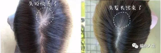 德国老太太用什么洗发水,93岁德国老太太