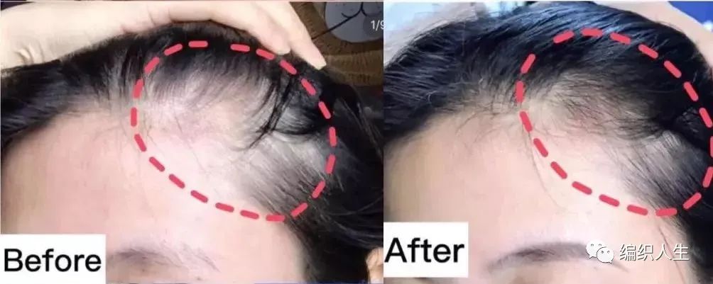 德国老太太用什么洗发水,93岁德国老太太