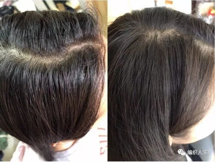 德国老太太用什么洗发水,93岁德国老太太