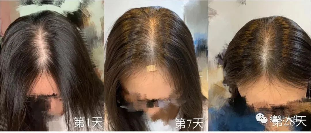 德国老太太用什么洗发水,93岁德国老太太