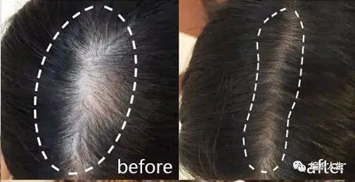 德国老太太用什么洗发水,93岁德国老太太