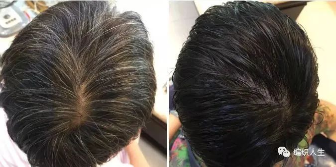 德国老太太用什么洗发水,93岁德国老太太