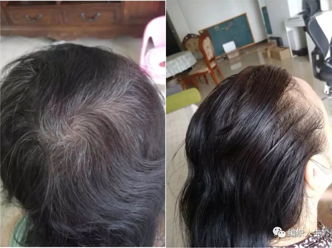 德国老太太用什么洗发水,93岁德国老太太