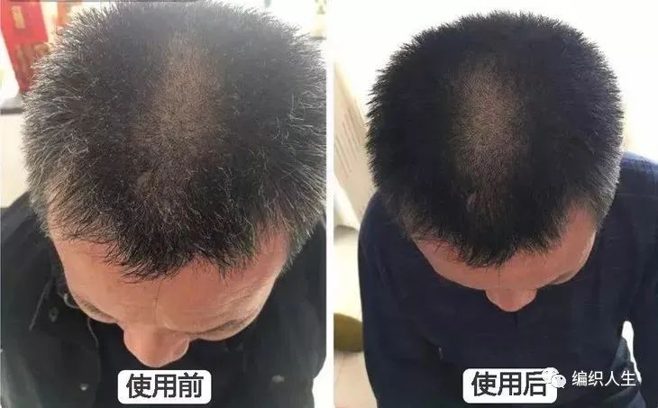 德国老太太用什么洗发水,93岁德国老太太