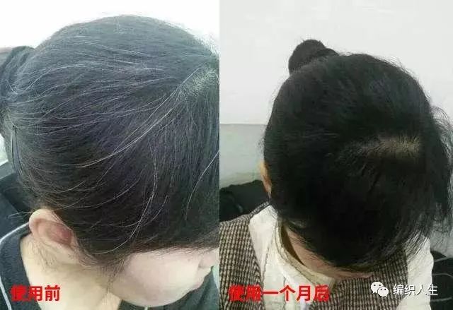 德国老太太用什么洗发水,93岁德国老太太