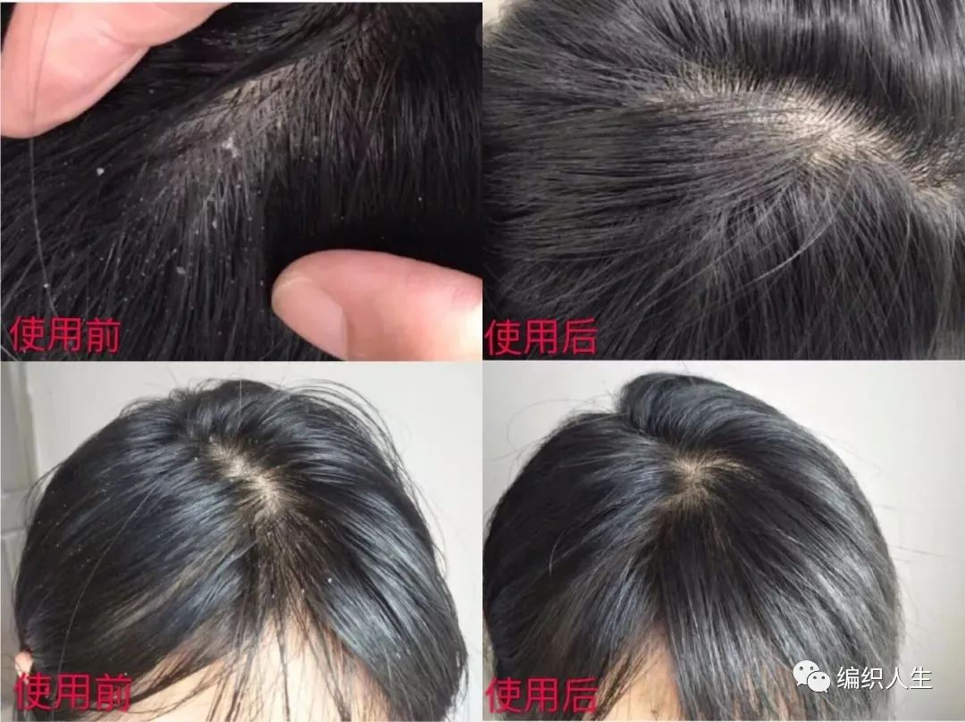 德国老太太用什么洗发水,93岁德国老太太