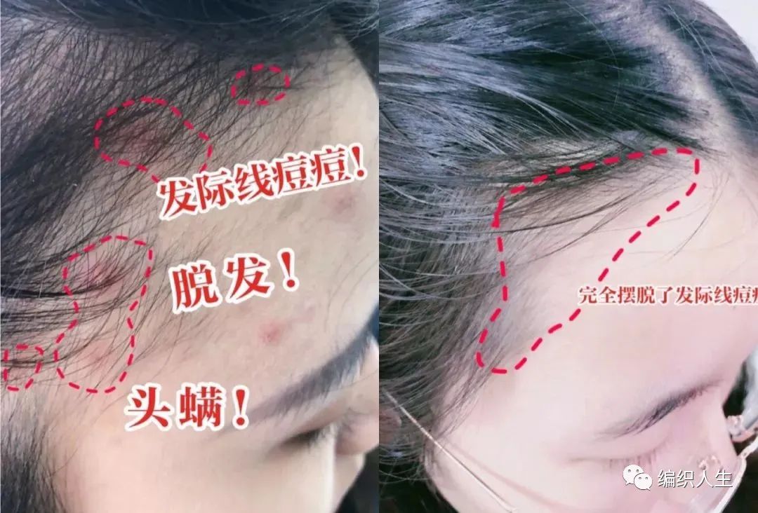 德国老太太用什么洗发水,93岁德国老太太