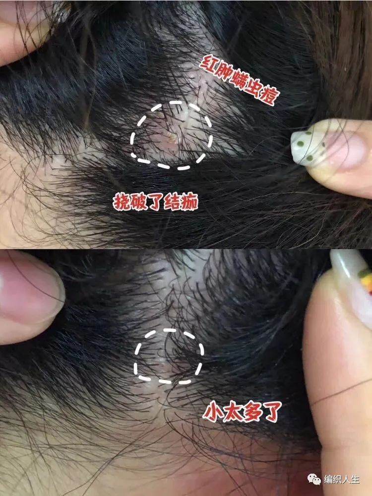 德国老太太用什么洗发水,93岁德国老太太