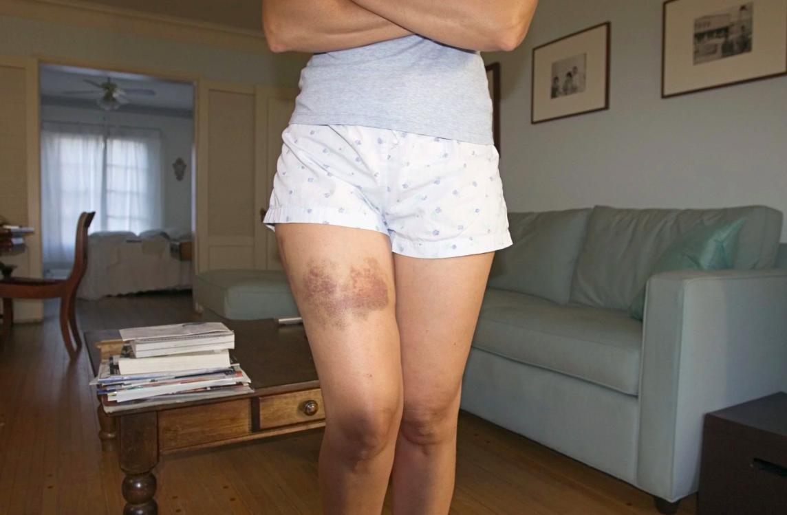 高云翔案重审第九天医生称女当事人当时拒绝阴部检查