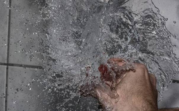 穿着衣服被开水烫伤急救,开水烫伤的急救措施