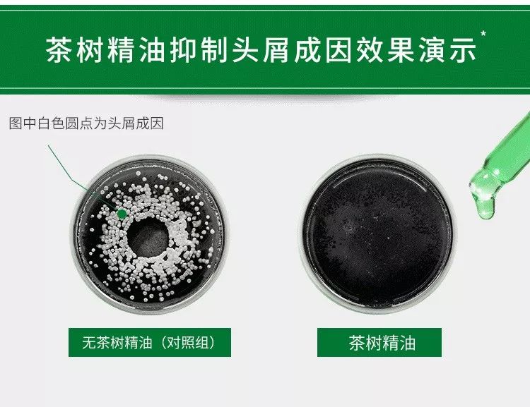 头上的螨虫用什么方法消除,头上又油又痒